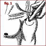Immagine che mostra l'applicazione di moxa descritta per fig.1