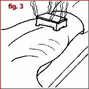 Immagine che mostra l'applicazione di moxa descritta per fig.3